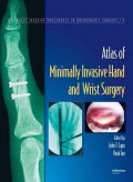 Atlas of minimally invasive hand and wrist surgery